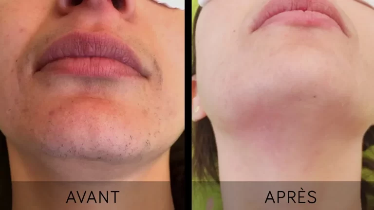 [Image de Comparaison Avant Après Minimize]
